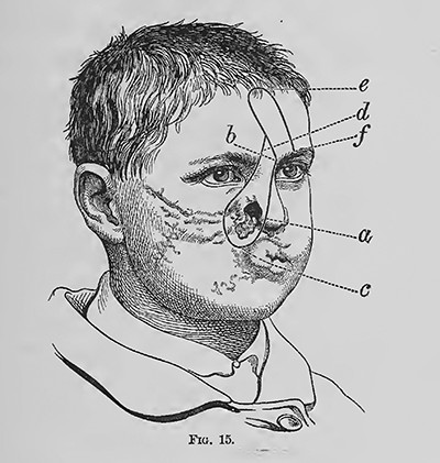 Von Notwendigkeit zu Konsum: Plastische Chirurgie im Spiegel der Zeit